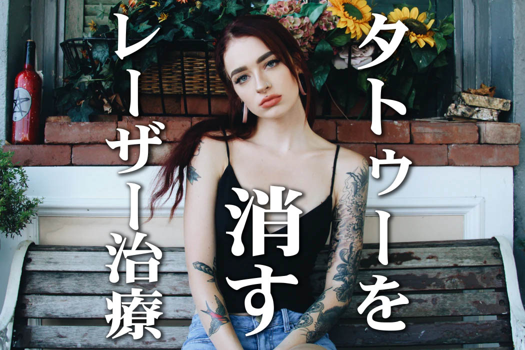 タトゥーを消す痛みはとても痛い【タトゥーの除去：レーザー治療】