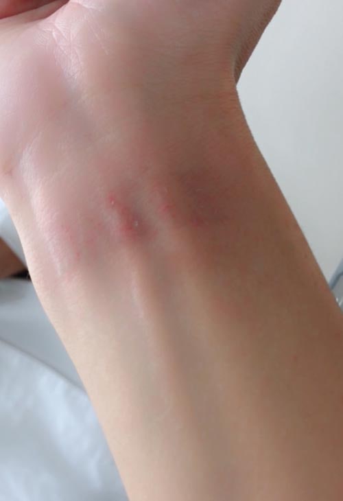 GENKINGさんの手首のタトゥ－の痕