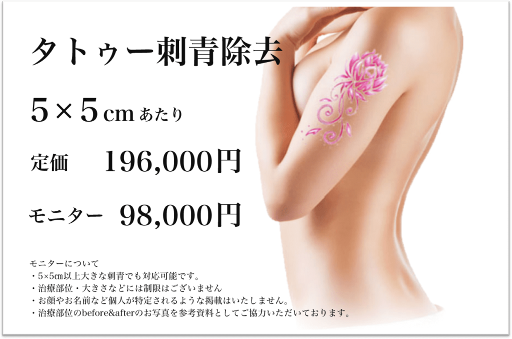 池袋サンシャイン美容外科のモニター価格