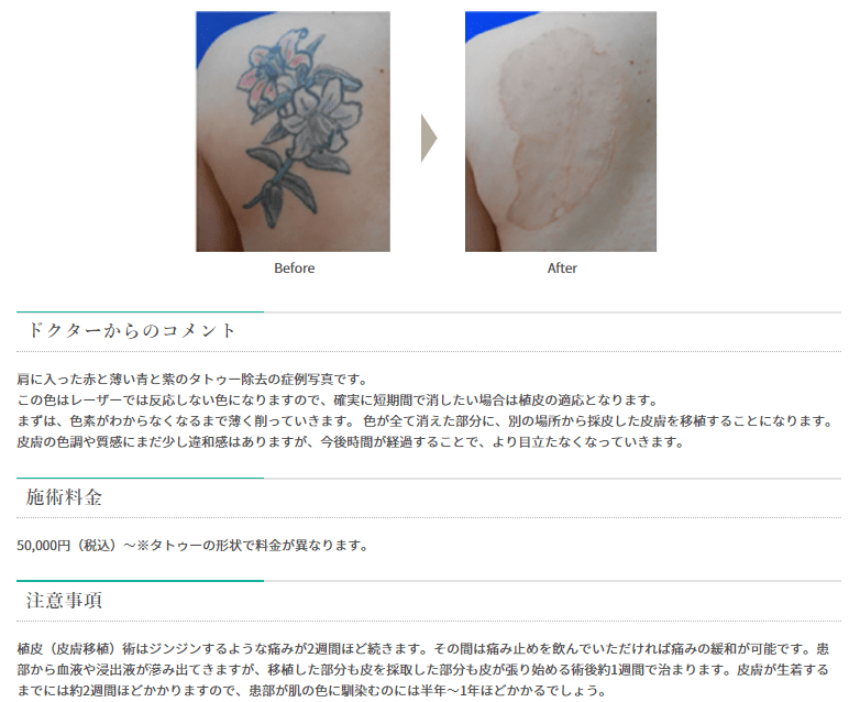 ガーデンクリニックでの症例